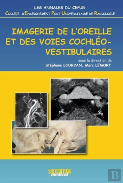 Bertrand.pt - Imagerie De L'Oreille Et Des Voies Cochléovestibulaires