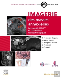 Bertrand.pt - Imagerie Des Masses Annexielles : Lexique O-Rads Et Corrélations Radiopathologiques