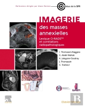 Imagerie Des Masses Annexielles : Lexique O-Rads Et Corrélations Radiopathologiques