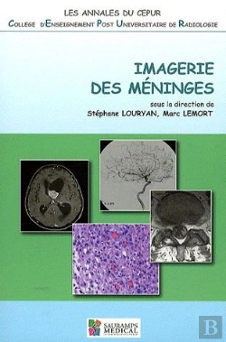 Bertrand.pt - Imagerie Des Méninges