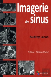 Imagerie Des Sinus