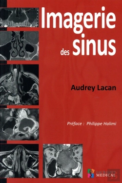 Bertrand.pt - Imagerie Des Sinus