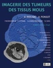 Imagerie Des Tumeurs Des Tissus Mous