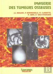 Imagerie Des Tumeurs Osseuses