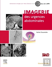Imagerie Des Urgences Abdominales
