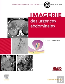 Bertrand.pt - Imagerie Des Urgences Abdominales