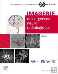 Bertrand.pt - Imagerie Des Urgences Neuroradiologiques