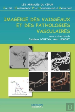 Bertrand.pt - Imagerie Des Vaisseaux Et Des Pathologies Vasculaires