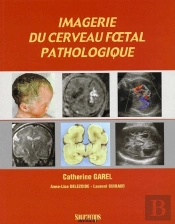 Imagerie Du Cerveau Foetal Pathologique