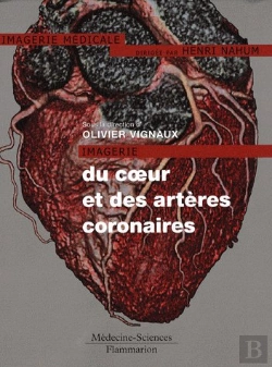 Bertrand.pt - Imagerie Du Coeur Et Des Arteres Coronaires Coll Imagerie Meditionicale