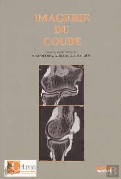 Bertrand.pt - Imagerie Du Coude
