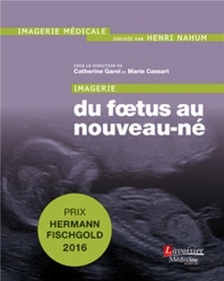 Bertrand.pt - Imagerie : Du Foetus Au Nouveau-Né