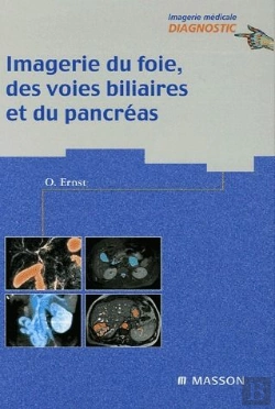 Bertrand.pt - Imagerie Du Foie, Des Voies Biliaires Et Du Pancréas