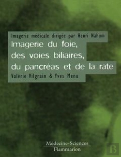 Bertrand.pt - Imagerie Du Foie Et Des Voies Biliaires ; 2e Edition
