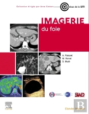 Imagerie Du Foie