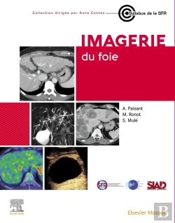 Bertrand.pt - Imagerie Du Foie