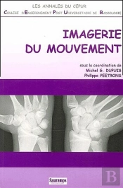 Imagerie Du Mouvement