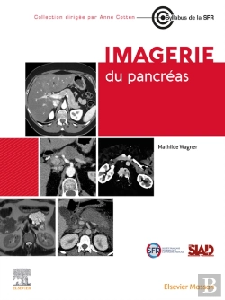 Bertrand.pt - Imagerie Du Pancreas