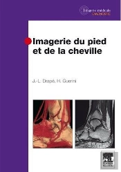 Imagerie Du Pied Et Cheville