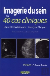 Imagerie Du Sein En 40 Cas Cliniques