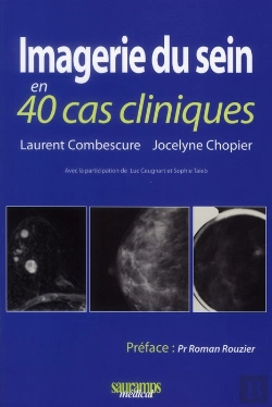 Bertrand.pt - Imagerie Du Sein En 40 Cas Cliniques