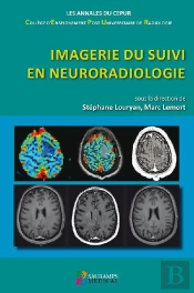 Imagerie Du Suivi En Neuroradiologie