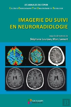 Bertrand.pt - Imagerie Du Suivi En Neuroradiologie
