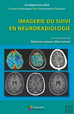 Bertrand.pt - Imagerie Du Suivi En Neuroradiologie