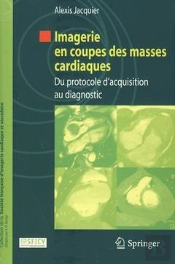 Imagerie En Coupes Des Masses Cardiaques ; Du Protocole D'Acquisition Au Diagnostic
