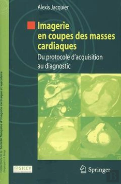 Bertrand.pt - Imagerie En Coupes Des Masses Cardiaques ; Du Protocole D'Acquisition Au Diagnostic