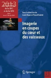 Imagerie En Coupes Du Coeur Et Des Vaisseaux