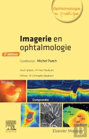 Imagerie En Ophtalmologie