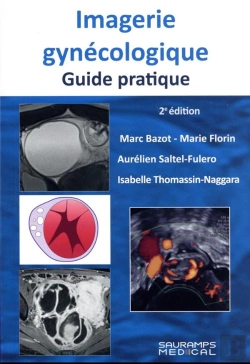 Bertrand.pt - Imagerie Gynecologique. Guide Pratique 2ed