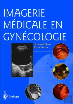 Bertrand.pt - Imagerie Médicale En Gynécologie