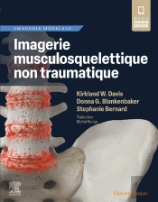 Imagerie Musculosquelettique Non Traumatique