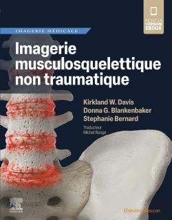 Bertrand.pt - Imagerie Musculosquelettique Non Traumatique