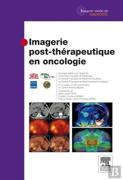 Bertrand.pt - Imagerie Post-Thérapeutique En Oncologie