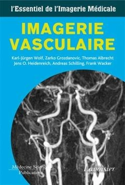 Bertrand.pt - Imagerie Vasculaire L'Essentiel De L'Imagerie Medicale