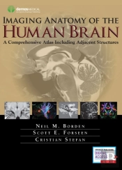 Imaging Anatomy Of The Human Brain