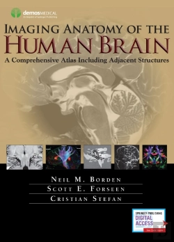 Bertrand.pt - Imaging Anatomy Of The Human Brain