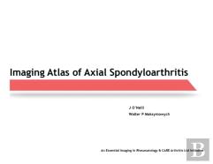 Imaging Atlas Of Axial Spondyloarthritis
