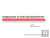 Imaging Atlas Of Axial Spondyloarthritis