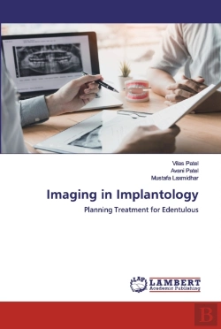 Bertrand.pt - Imaging In Implantology