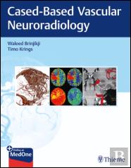 Imaging in Neurovascular Disease