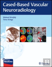 Imaging in Neurovascular Disease