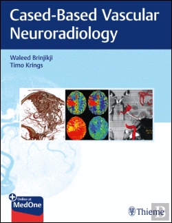 Bertrand.pt - Imaging in Neurovascular Disease