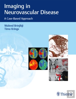 Bertrand.pt - Imaging In Neurovascular Disease
