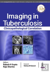 Imaging In Tuberculosis