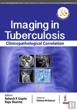 Bertrand.pt - Imaging In Tuberculosis