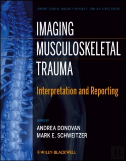 Bertrand.pt - Imaging Musculoskeletal Trauma